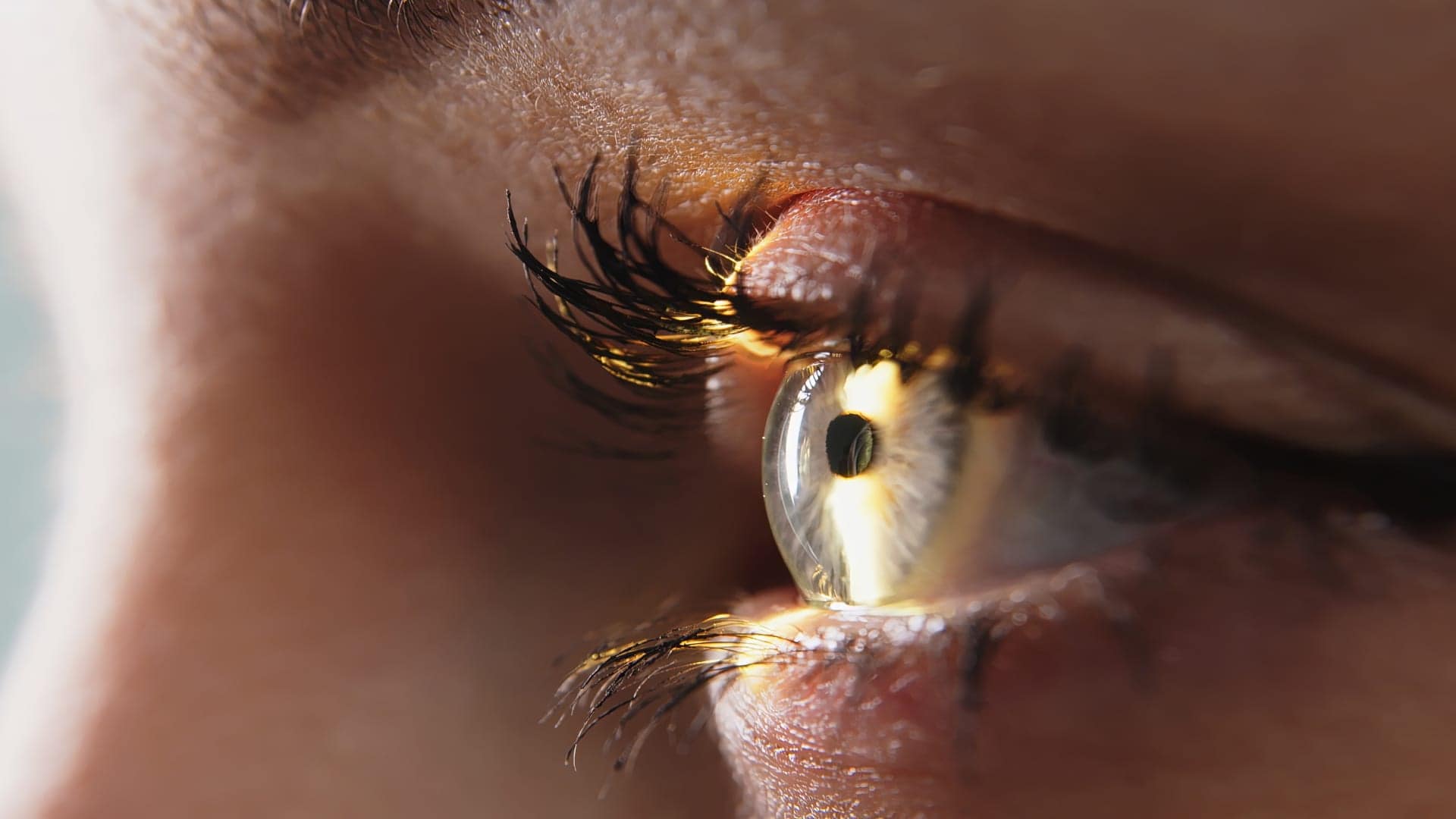 centre union laser vision chirurgie refractive operation cataracte laser yeux clinique ophtalmologique toulouse