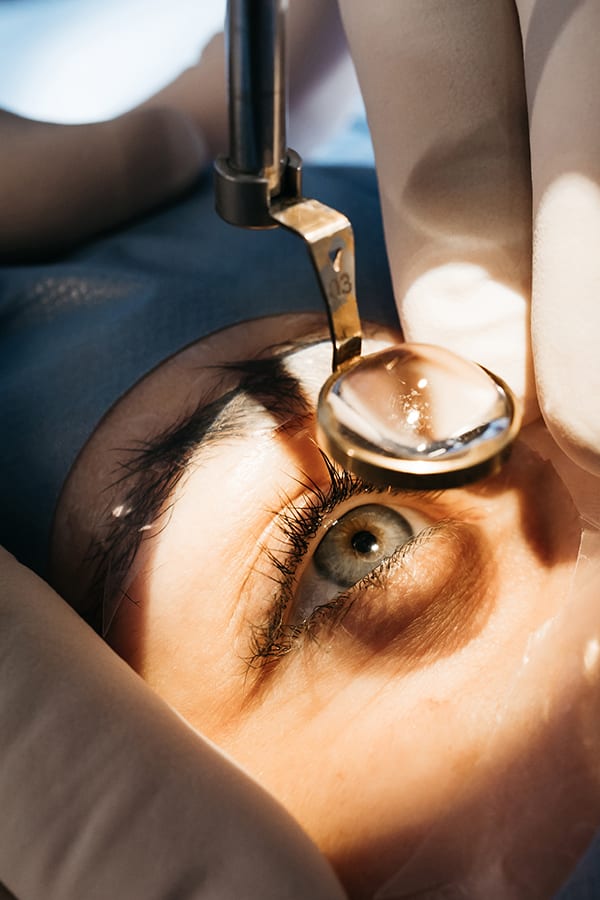 prelex centre union laser vision chirurgie refractive toulouse specialistes ophtalmologie