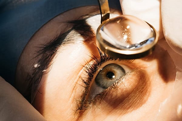 prelex centre union laser vision toulouse chirurgie refractive toulouse specialistes ophtalmologie